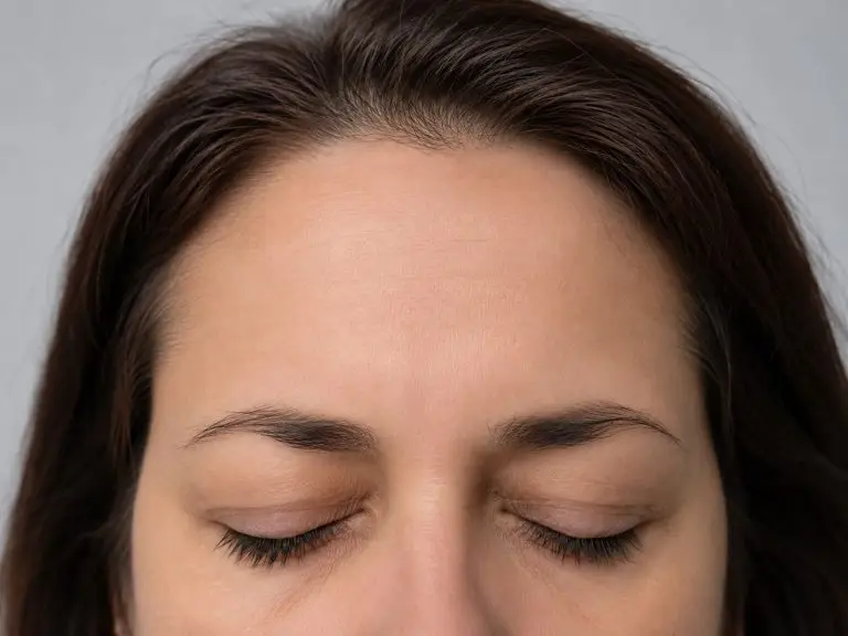 Botulinum Toxin