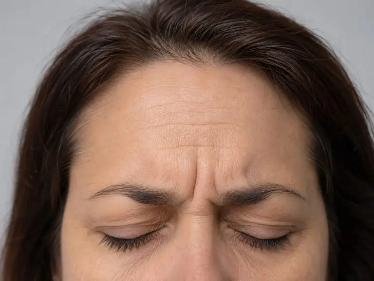 Botulinum Toxin