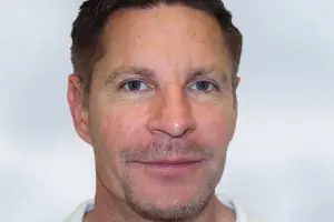 Sculptra George After